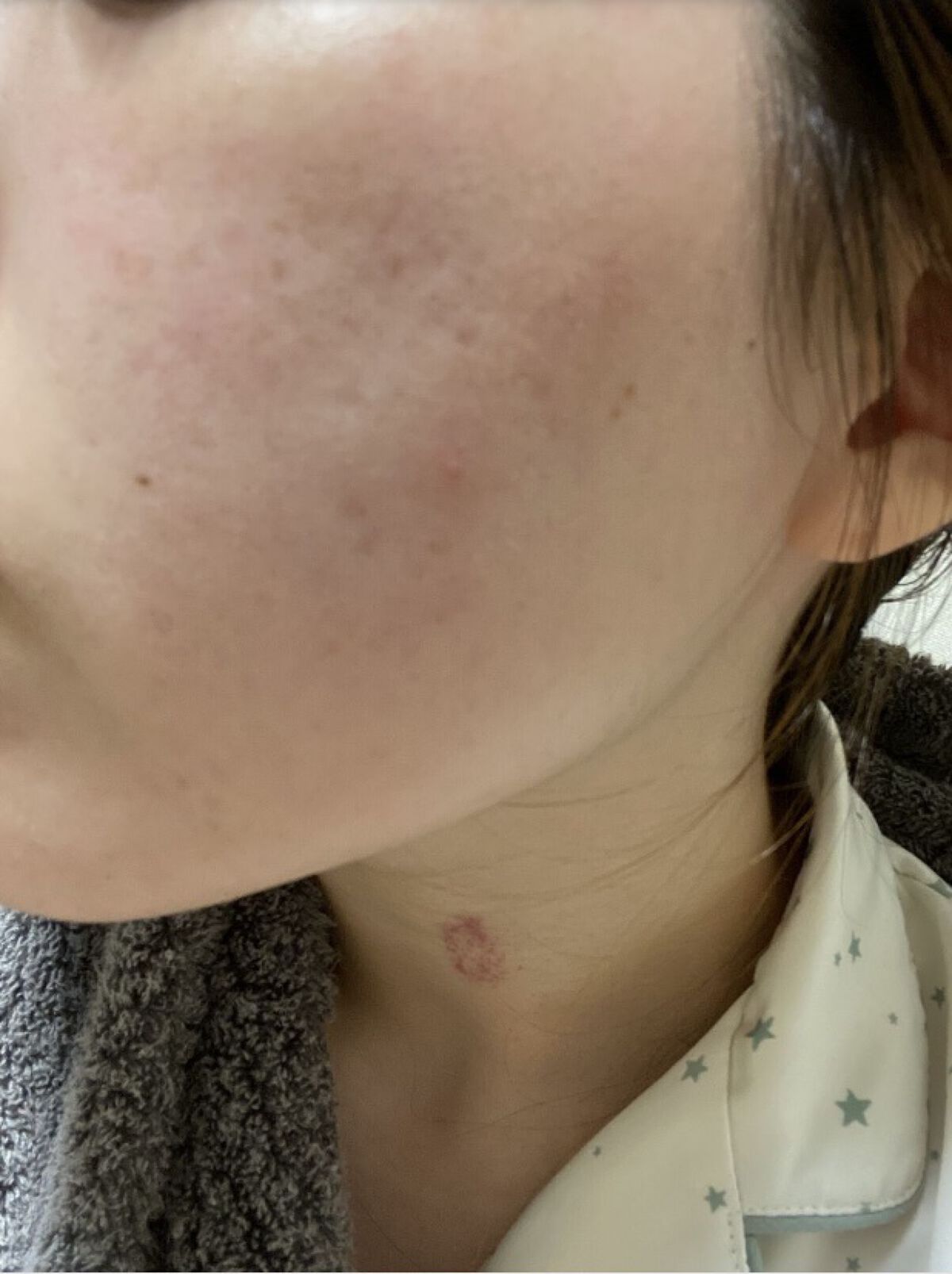 ナチュラボ 生ハーブピーリング/石澤研究所/ピーリングを使ったクチコミ（3枚目）