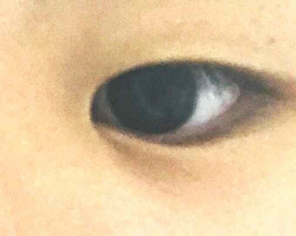 【旧品】オリシキ アイリッドスキンフィルム/D-UP/二重まぶた用アイテムを使ったクチコミ（2枚目）