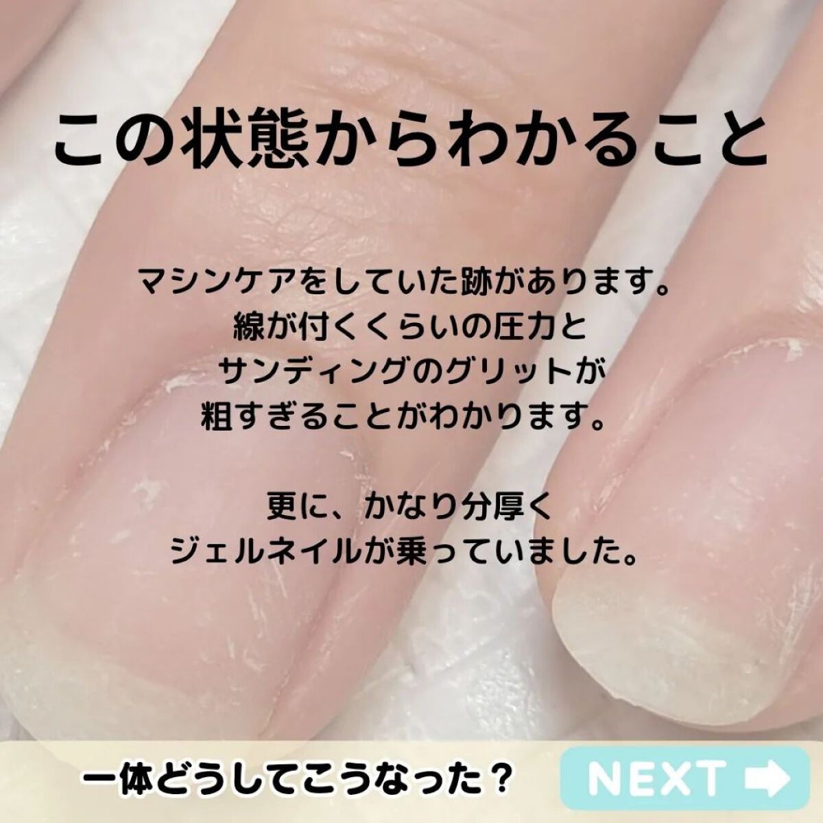 TSUMECARE/NailSalon mayunail/ネイルオイル・トリートメントを使ったクチコミ（2枚目）