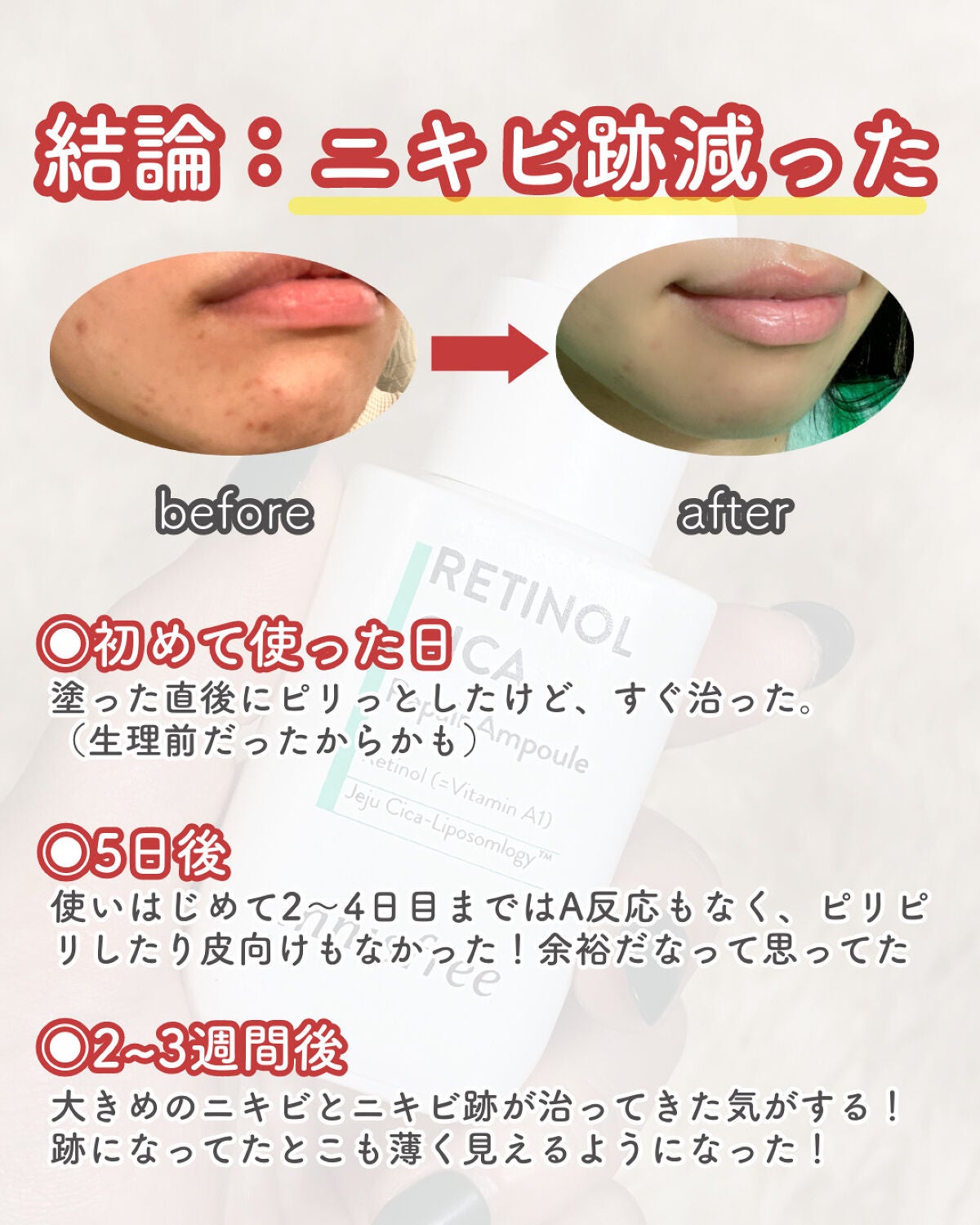 レチノール シカ リペア セラム/innisfree/美容液を使ったクチコミ(5枚目)