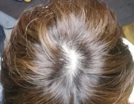 泡カラー/リーゼ/ヘアカラーを使ったクチコミ(4枚目)