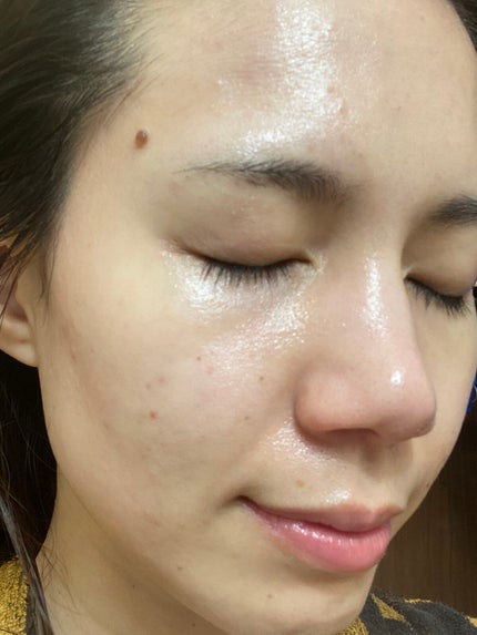 生VC美白美容液/Yunth/美容液を使ったクチコミ(2枚目)