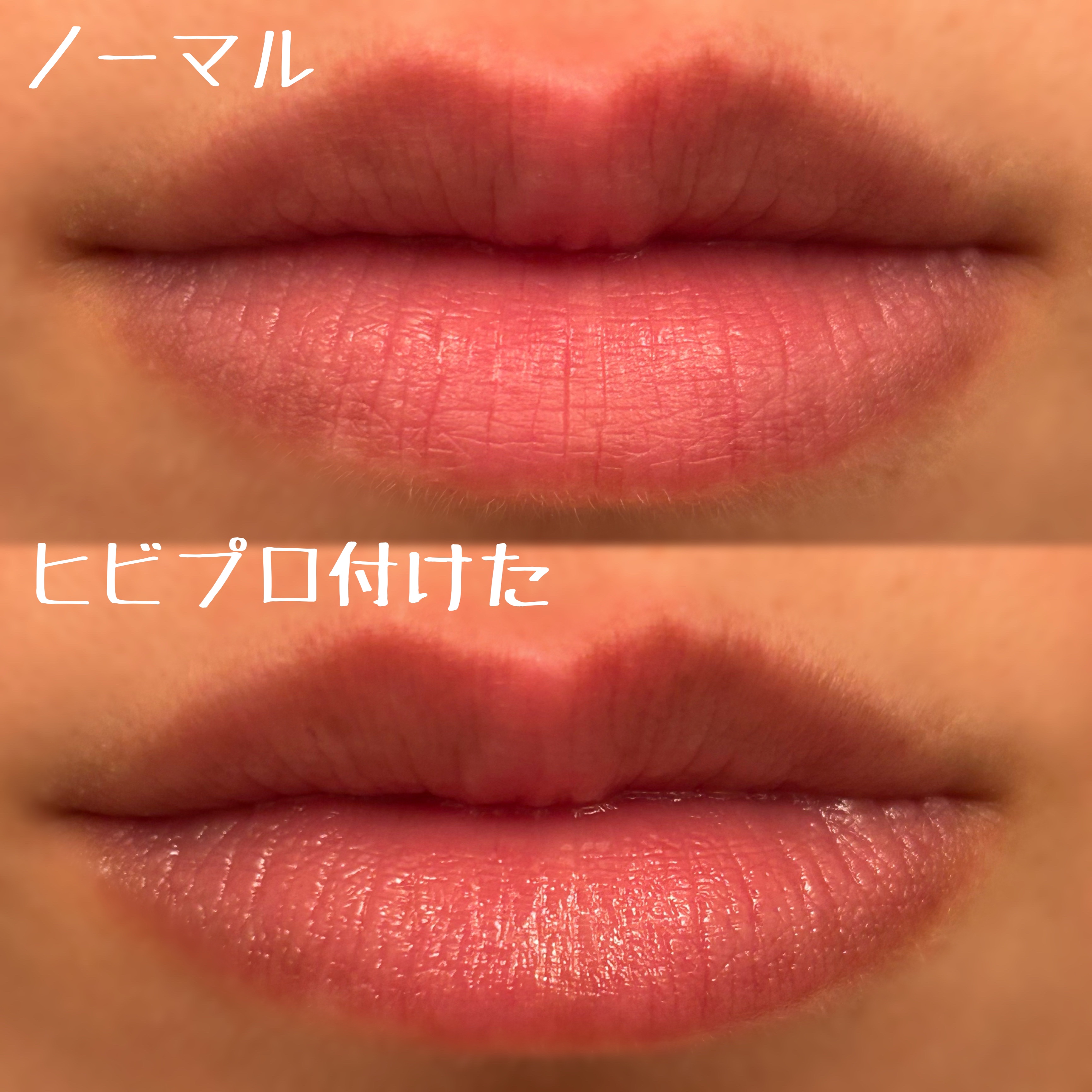 ヒビプロLP(医薬品)/メンソレータム/その他を使ったクチコミ（2枚目）