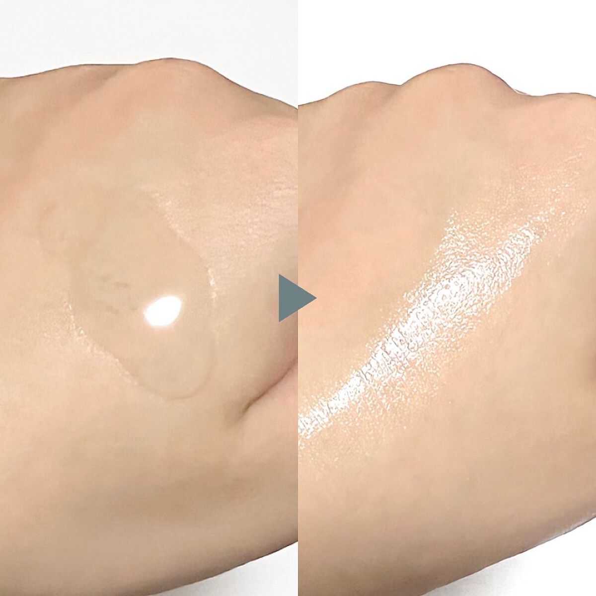 シラカバ70%水分ブースティングセラム/Anua/美容液を使ったクチコミ(5枚目)