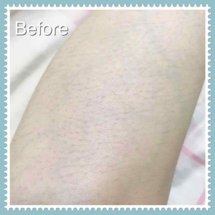 スムーズスキン/DAISO/ムダ毛ケアを使ったクチコミ(2枚目)