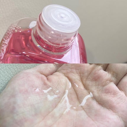 ピンクティーツリートナー/APLIN/化粧水を使ったクチコミ(2枚目)