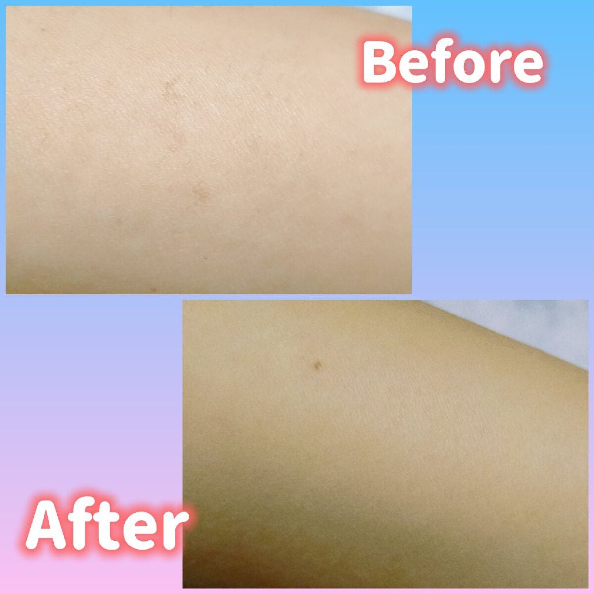 ミュゼコスメ メンズ 薬用ヘアリムーバルクリーム ホワイトシトラスの香り/ミュゼコスメ/除毛クリームを使ったクチコミ(4枚目)