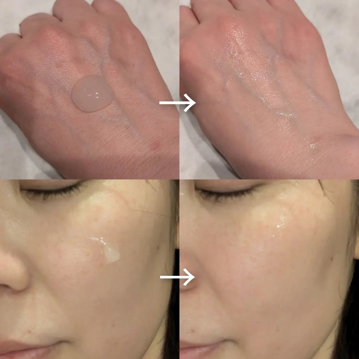 モイストゲルプラス/Re dermalab/オールインワン化粧品を使ったクチコミ（2枚目）