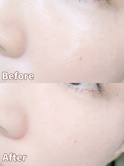 スノービューティー ブライトニング スキンケアパウダーA (医薬部外品)/スノービューティー/プレストパウダーを使ったクチコミ(6枚目)