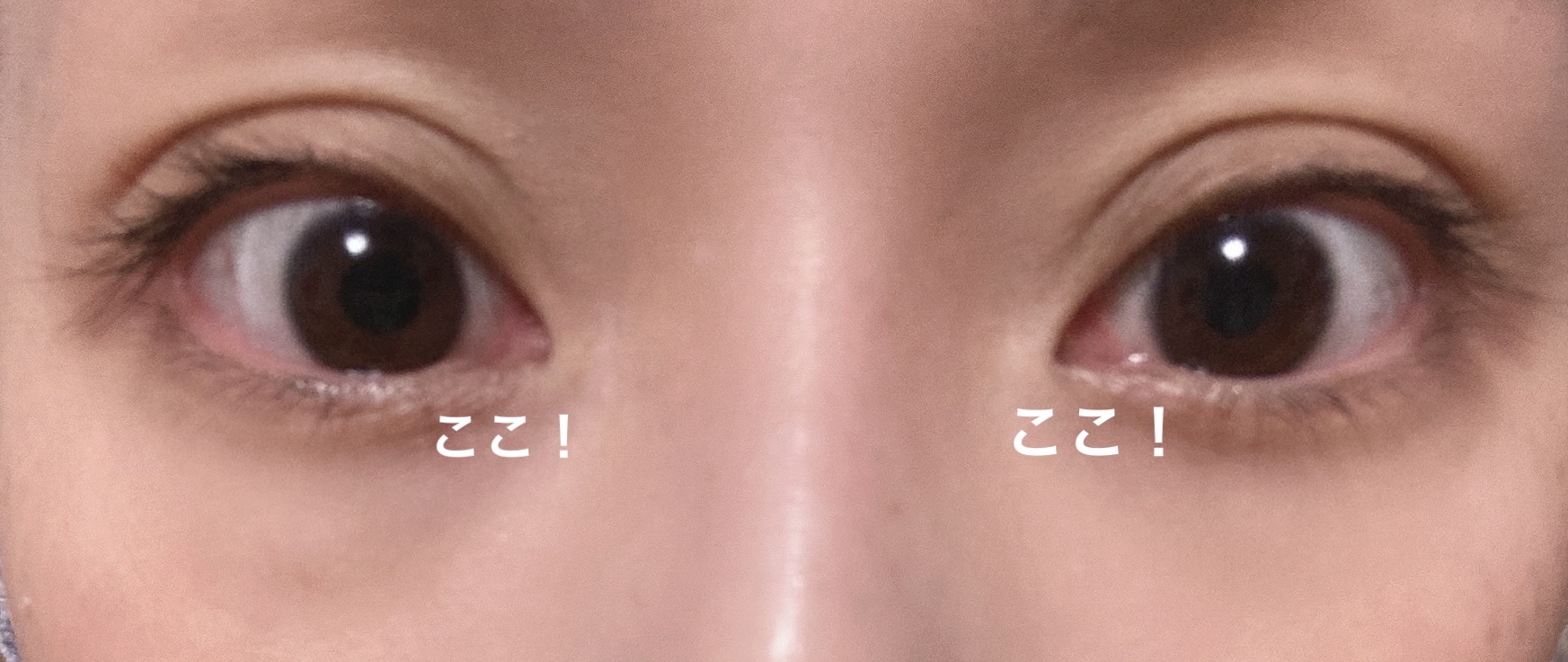 スマイルホワイティエ(医薬品)/ライオン/その他を使ったクチコミ（1枚目）