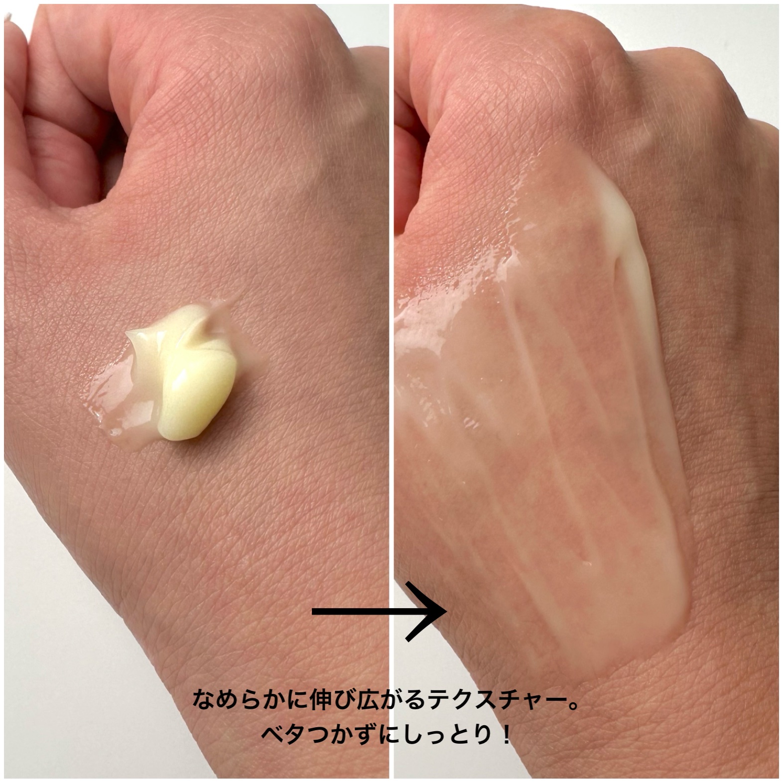 薬用アクアコラーゲンゲル エンリッチリンクルリペア/ドクターシーラボⓇ/フェイスクリームを使ったクチコミ（3枚目）