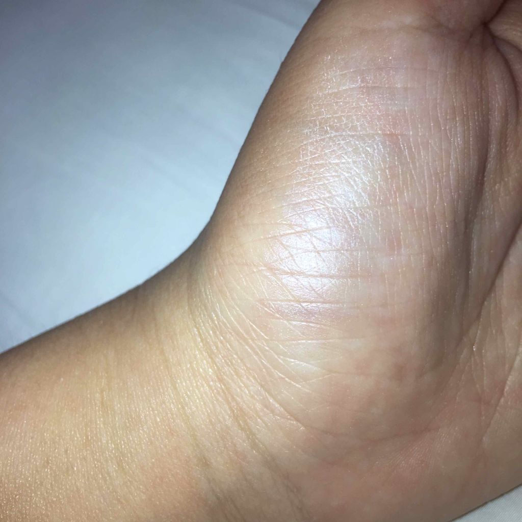 ヴィセ アヴァン パーフェクトフィニッシュ グロウ/Visée/プレストパウダーを使ったクチコミ（3枚目）