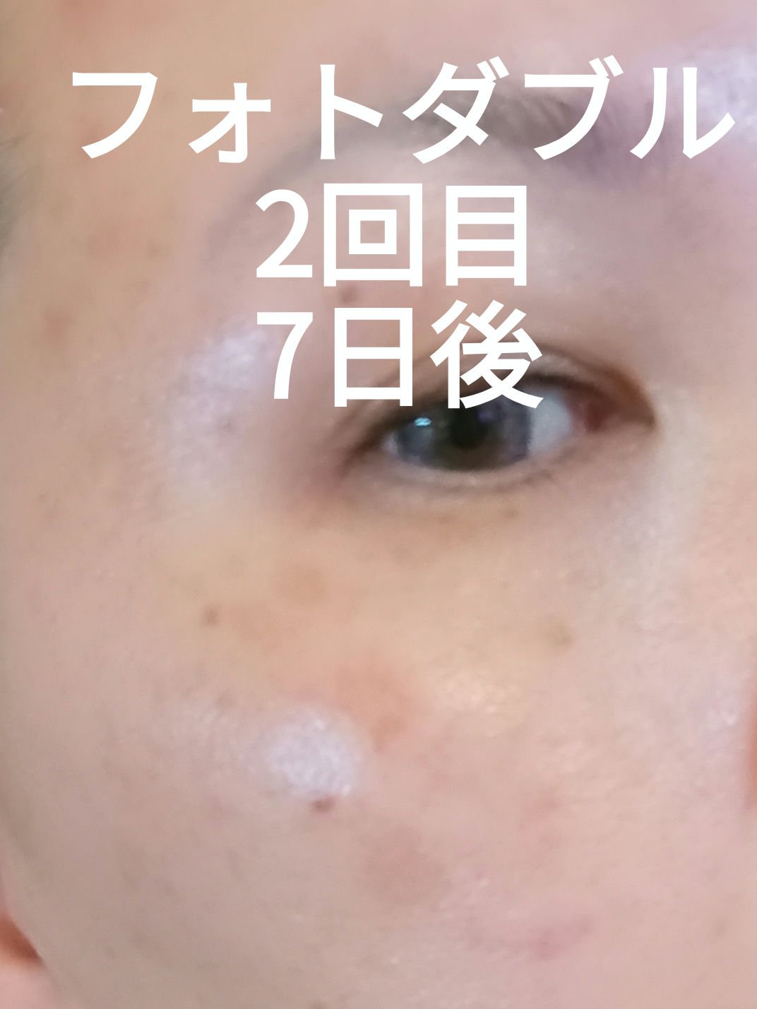 フォトダブル/SBC/その他を使ったクチコミ（3枚目）