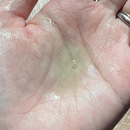 アゼライン酸15 インテンスカーミングセラム/Anua/美容液を使ったクチコミ(4枚目)