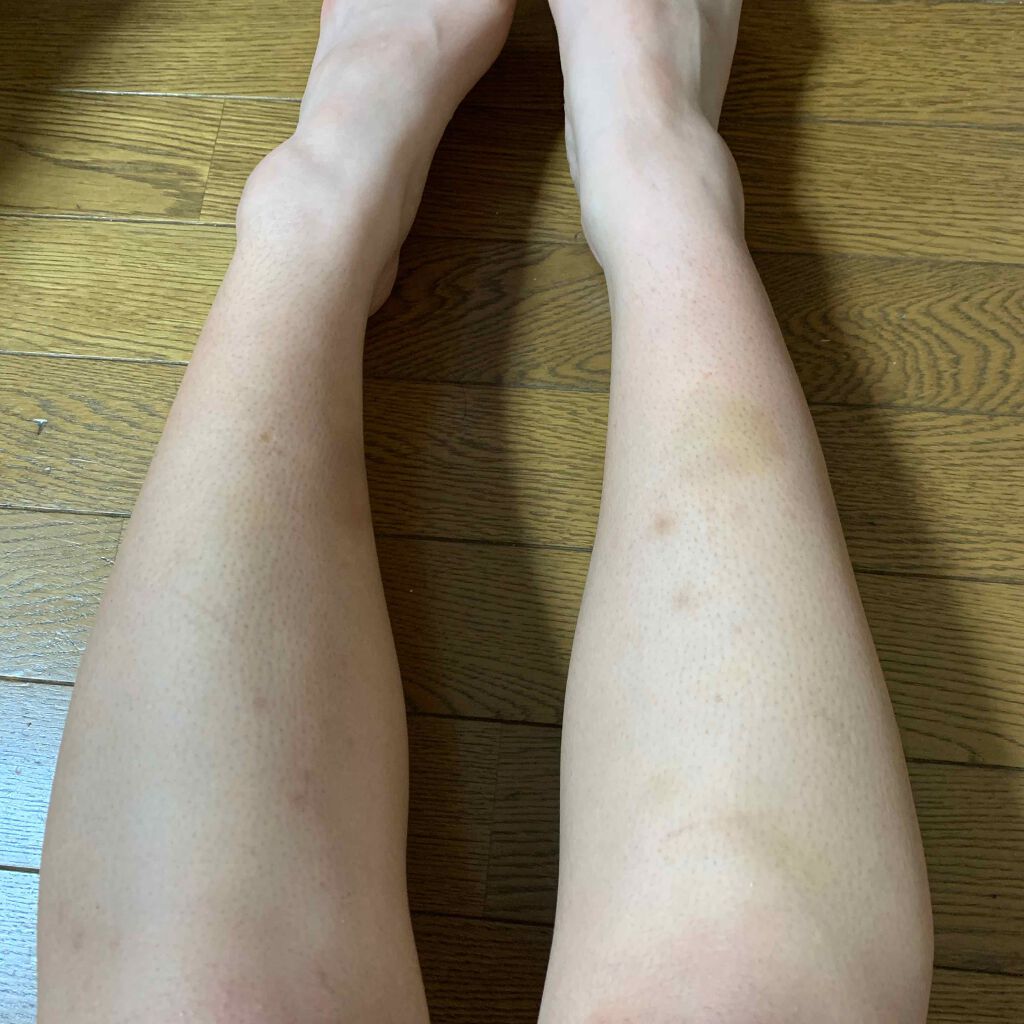 らぶり on LIPS 「足の毛穴が目立って足を出すのが嫌です。ずっと悩んでます。ケアの..」(1枚目)