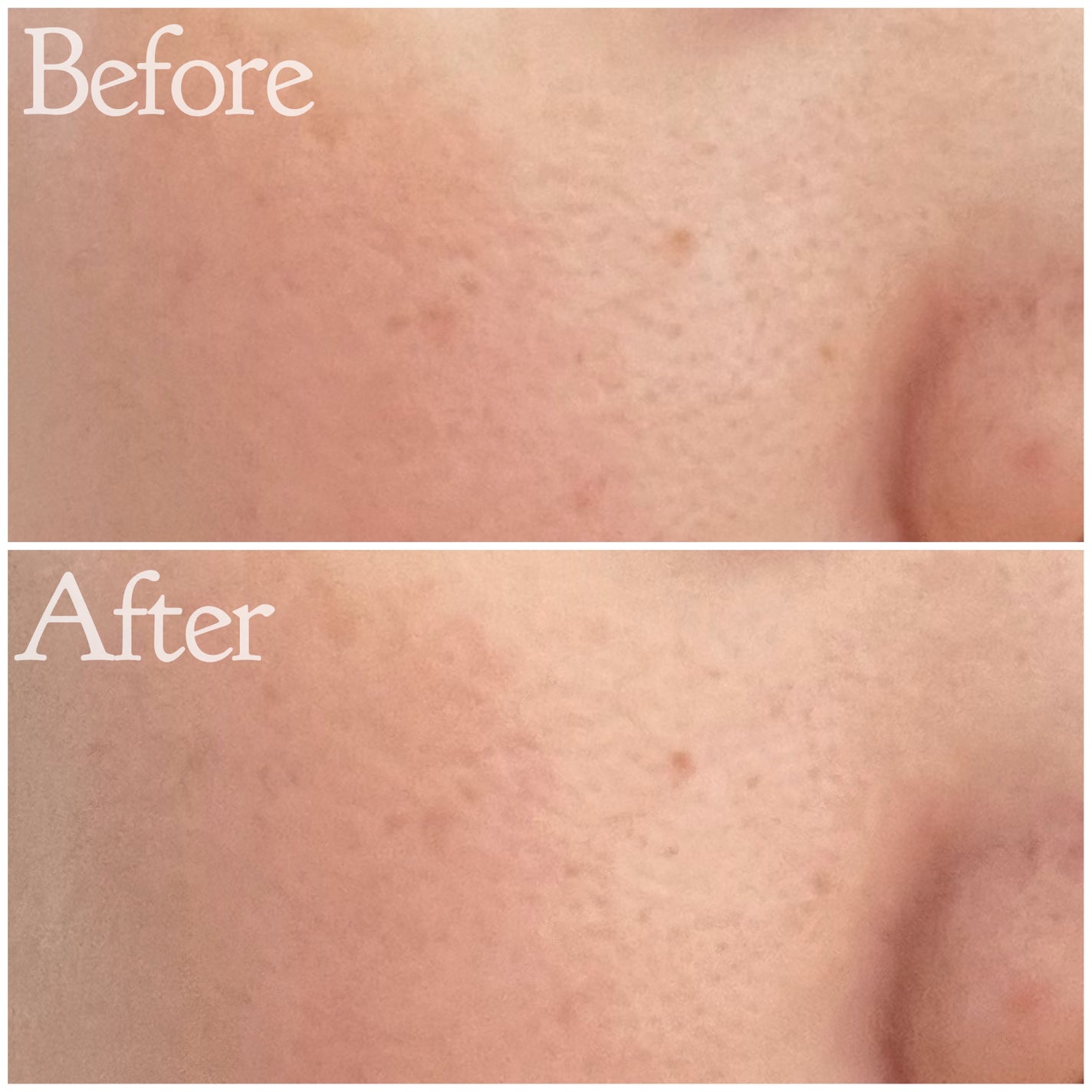 プリマヴィスタ デイトリートメントバーム 〈ローラータイプ〉/プリマヴィスタ/その他ファンデーションを使ったクチコミ(4枚目)