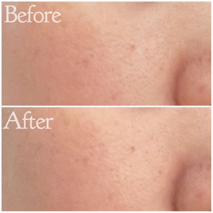 プリマヴィスタ デイトリートメントバーム 〈ローラータイプ〉/プリマヴィスタ/その他ファンデーションを使ったクチコミ(4枚目)