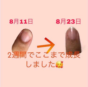 2週間の爪ケア！！！！

爪噛み女から美爪を目指して⭐️

人差し指に1番効果がみられたのでそこを
詳しく載せてみました！！！

指が黒すぎるのは見逃してください笑

わたしがしたこと

①朝昼夜にハン