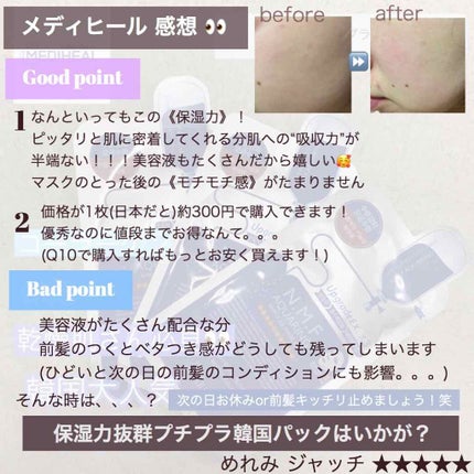 N.M.FアクアアンプルマスクJEX/MEDIHEAL/シートマスク・パックを使ったクチコミ(2枚目)