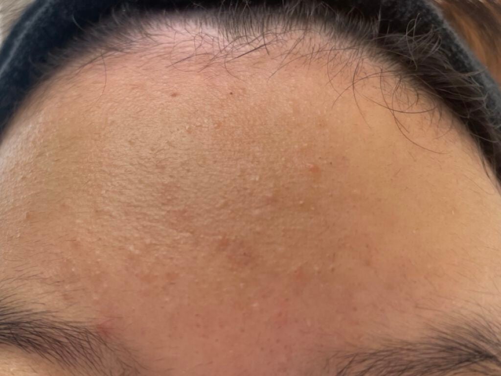 クリアフル ウォッシュ/オルビス/洗顔フォームを使ったクチコミ(3枚目)