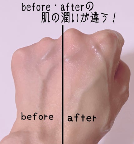 フィグブースティングエッセンス/I'm from/化粧水を使ったクチコミ(4枚目)