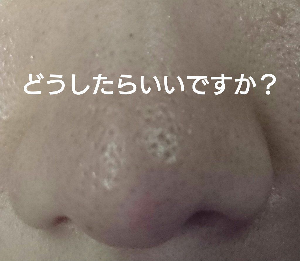 オバジC 酵素洗顔パウダー/オバジ/洗顔パウダーを使ったクチコミ（1枚目）