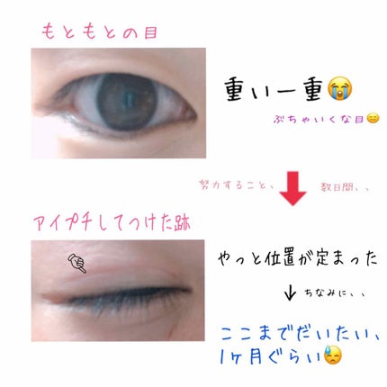 アイトーク/アイトーク/二重まぶた用アイテムを使ったクチコミ(1枚目)