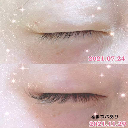 ラッシュアディクト アイラッシュコンディショニングセラム/soaddicted/まつげ美容液を使ったクチコミ(2枚目)