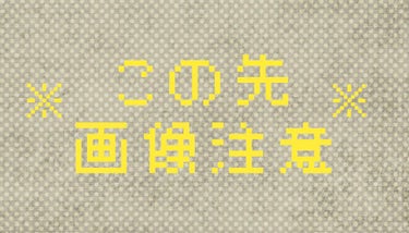 夢みるバーム 白泥リフトモイスチャー/ロゼット/クレンジングバームを使ったクチコミ（1枚目）