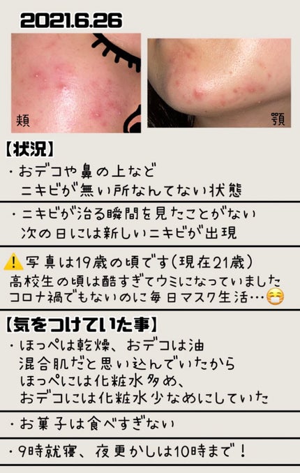 明色美顔水 薬用化粧水/美顔/化粧水を使ったクチコミ(2枚目)