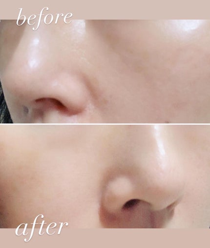 CICA デイリースージングマスク/VT/シートマスク・パックを使ったクチコミ(7枚目)