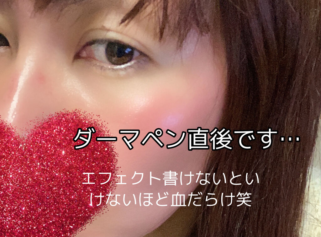 浸透湿潤セラミド１０％★ナノエマルジョン/TOUT VERT/乳液を使ったクチコミ（2枚目）