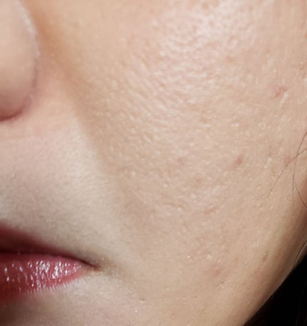 BBクリーム/アンテリージェEX/BBクリームを使ったクチコミ(2枚目)