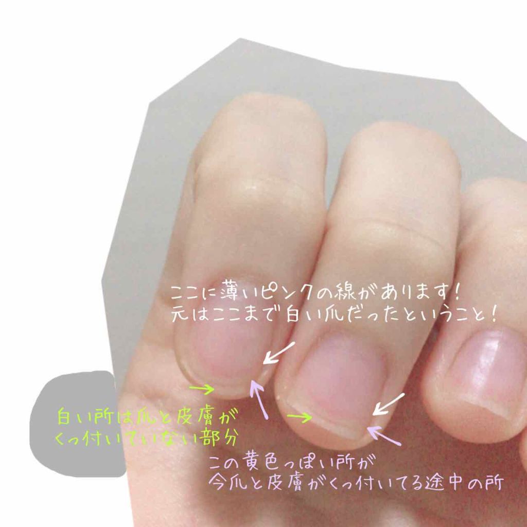 AC キューティクルオイル/AC MAKEUP/ネイルオイル・トリートメントを使ったクチコミ(2枚目)