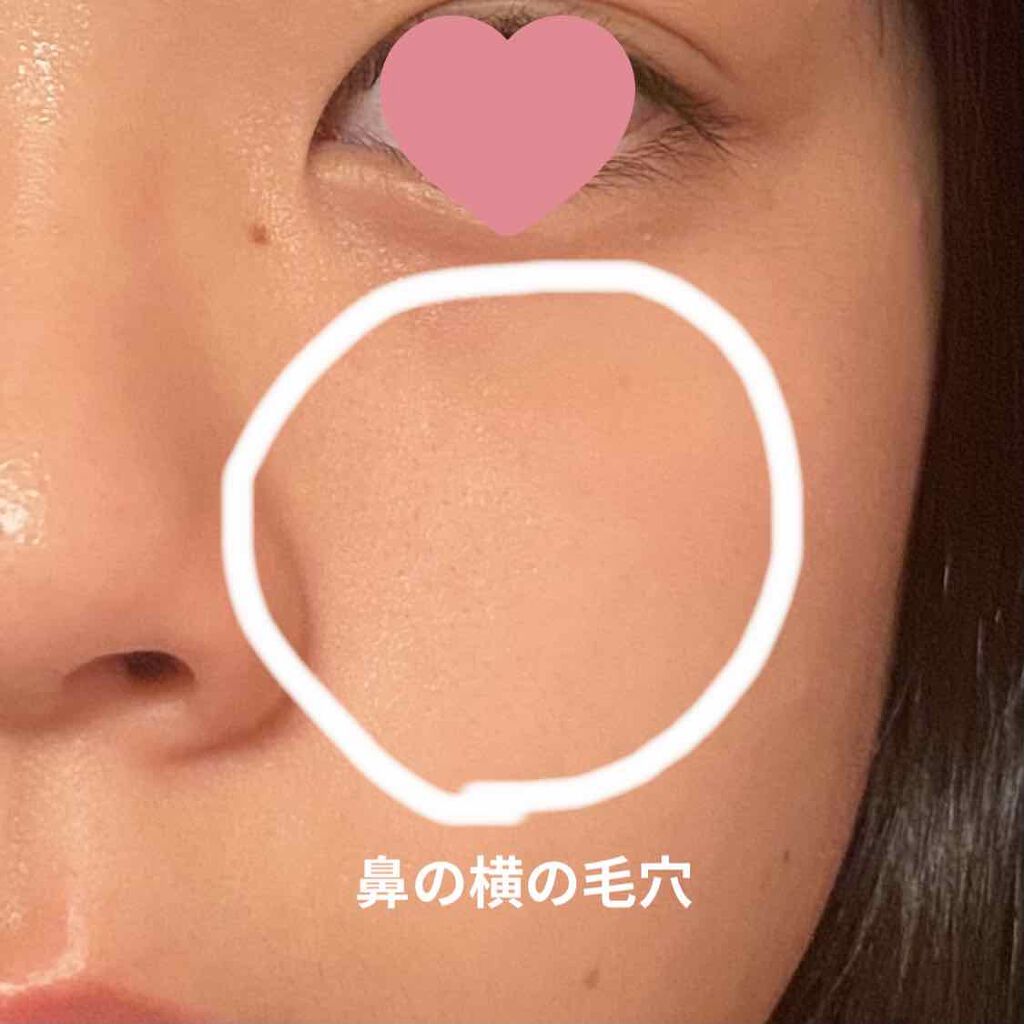 芋子 on LIPS 「誰か助けてください!あまり写真では見えにくいのですが、鼻の毛穴..」(3枚目)