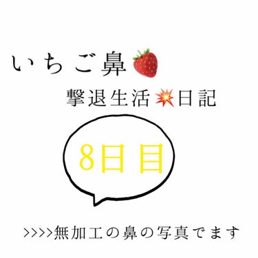 いちご鼻撃退日記8日目！

今日は比較する為に、いつも通りの方法で
やってみました！

ベビーオイルは継続してやると減る感じがして、
ワセリンは1回で効果がある感じがしました！


#いちご鼻 #毛穴ケ