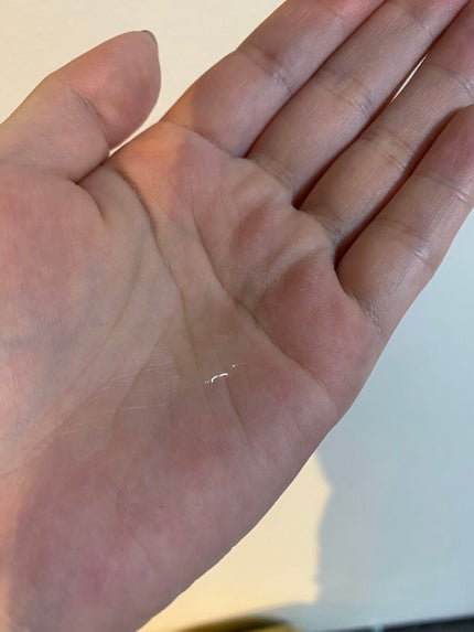 VC100エッセンスローション EX/ドクターシーラボⓇ/化粧水を使ったクチコミ(2枚目)