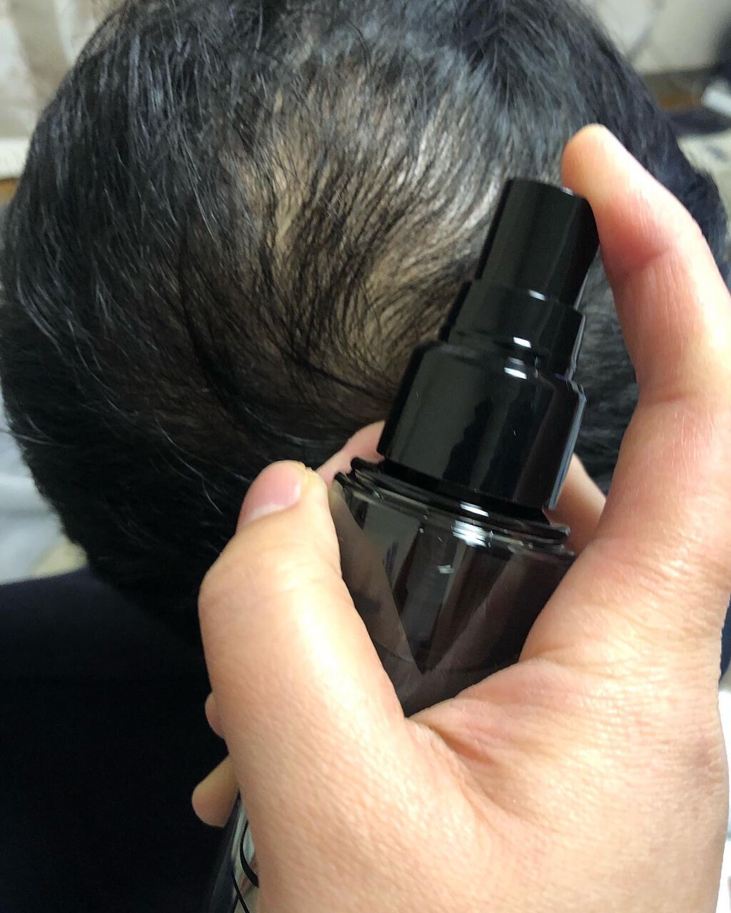 モウダス 薬用 発毛促進剤/北の快適工房/頭皮ローションを使ったクチコミ（3枚目）