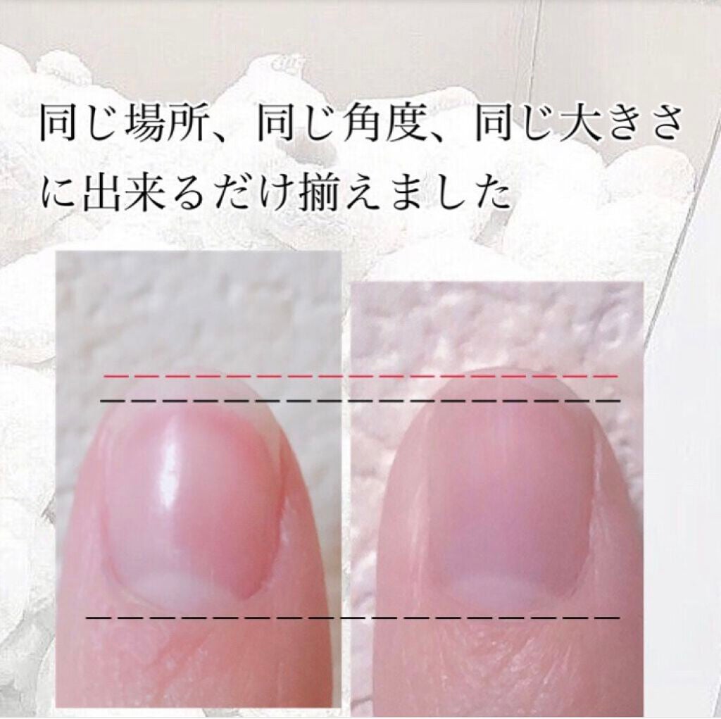 ウィンマックス キューティクルオイル/DAISO/ネイルオイル・トリートメントを使ったクチコミ(2枚目)