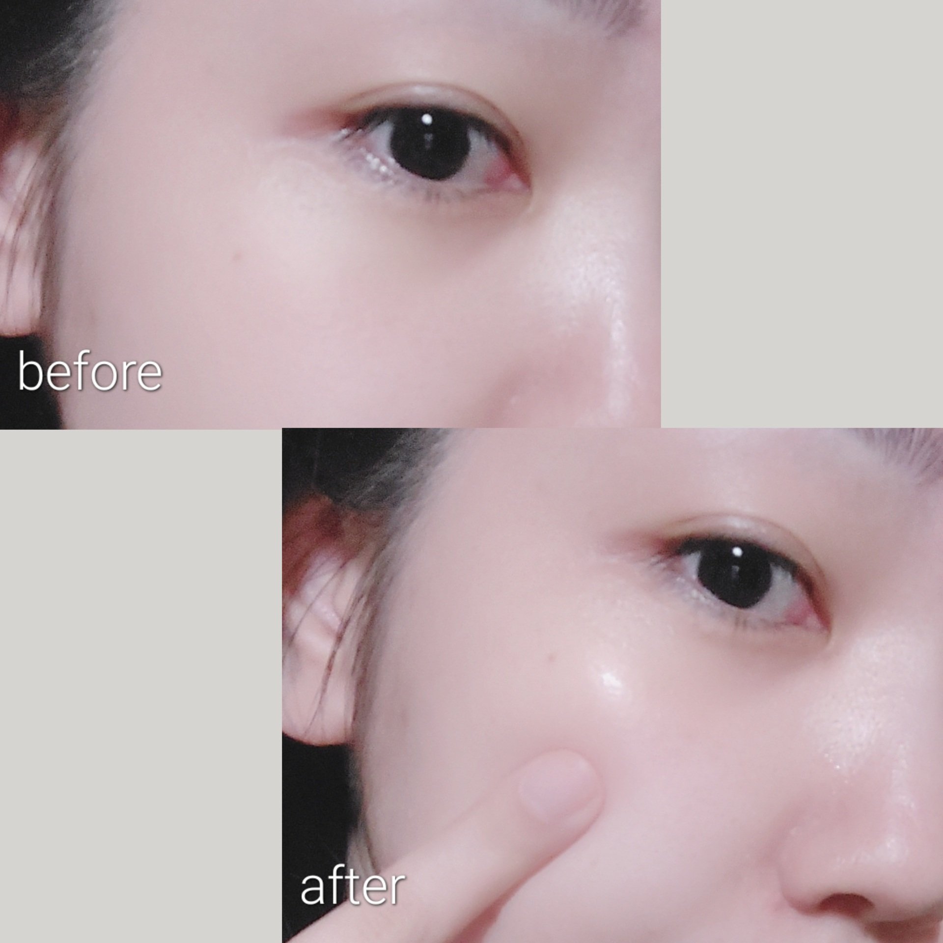 グリーン カーミングマルチバーム/Free Moment /フェイスバームを使ったクチコミ（3枚目）