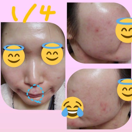 キールズ ミッドナイトボタニカル コンセントレート/Kiehl's/フェイスオイルを使ったクチコミ(2枚目)