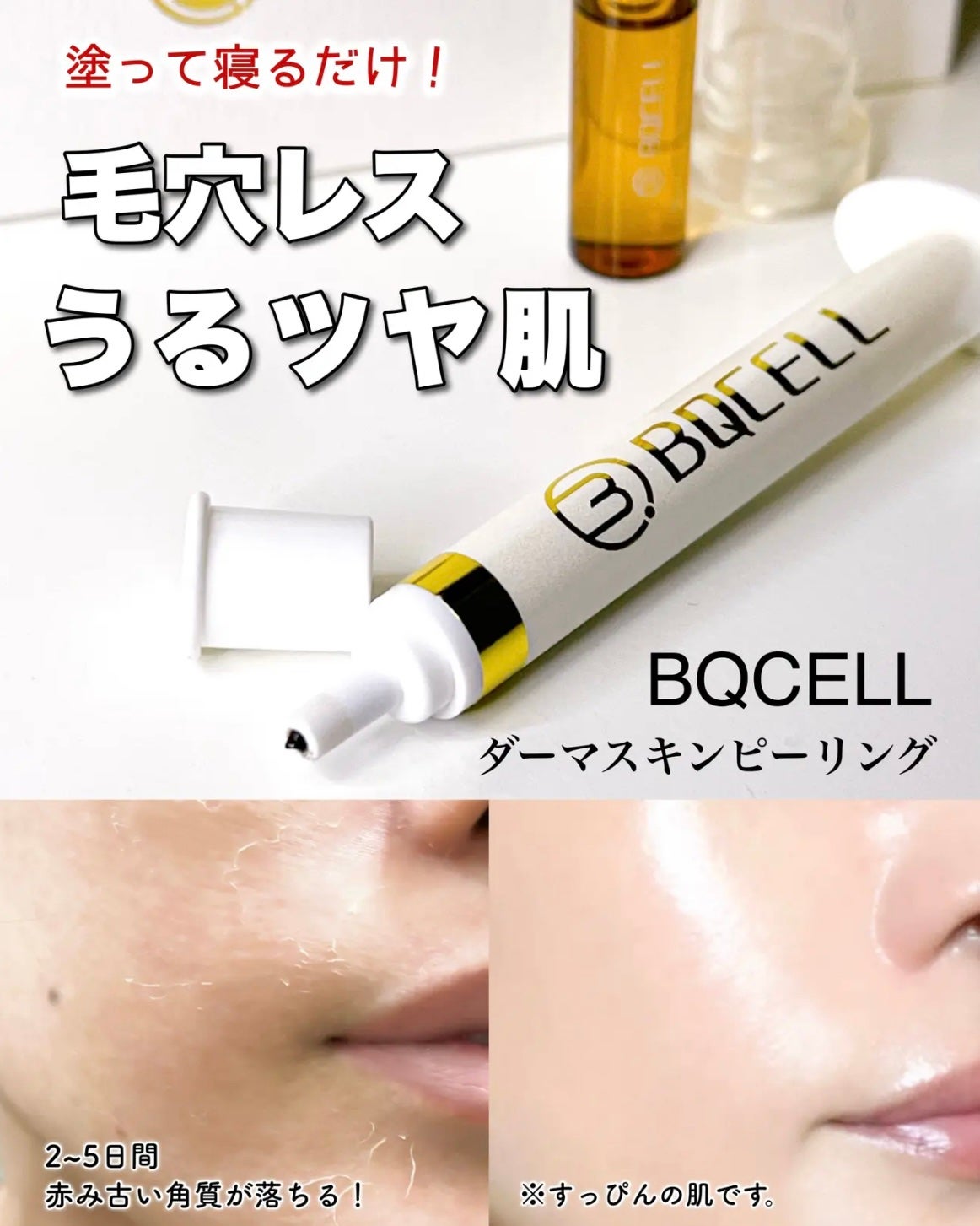 ダーマスキンピーリング/BQCELL/その他キットセットを使ったクチコミ(1枚目)