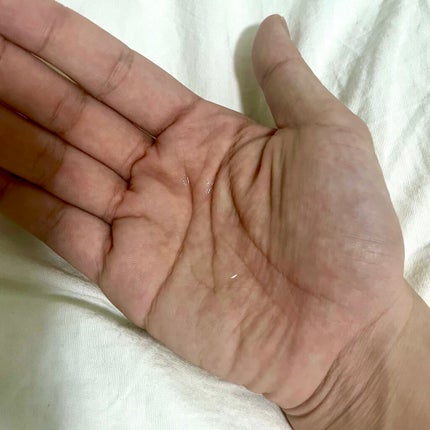 ヒアロビューティー モイストリペアエッセンス 5本入/太陽のアロエ社/美容液を使ったクチコミ(5枚目)