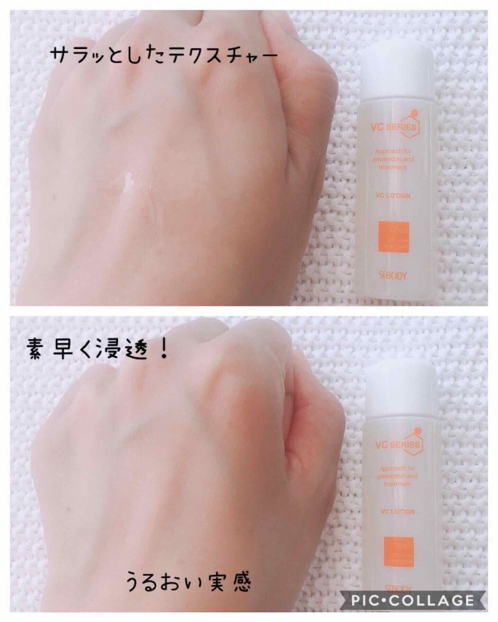 VCスターターセット/VCシリーズ/スキンケアキットを使ったクチコミ(2枚目)