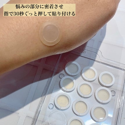 エーキュアショットスポットパッチ/obsero/にきびパッチを使ったクチコミ(2枚目)