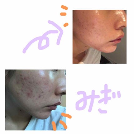 アンチ-ブレミッシュ マスク/Aesop/洗い流すパック・マスクを使ったクチコミ(2枚目)