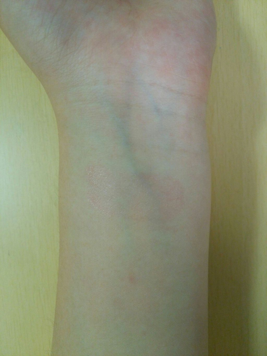 チェリーモイスチャー リップグロウ/ETUDE/リップグロスを使ったクチコミ(4枚目)