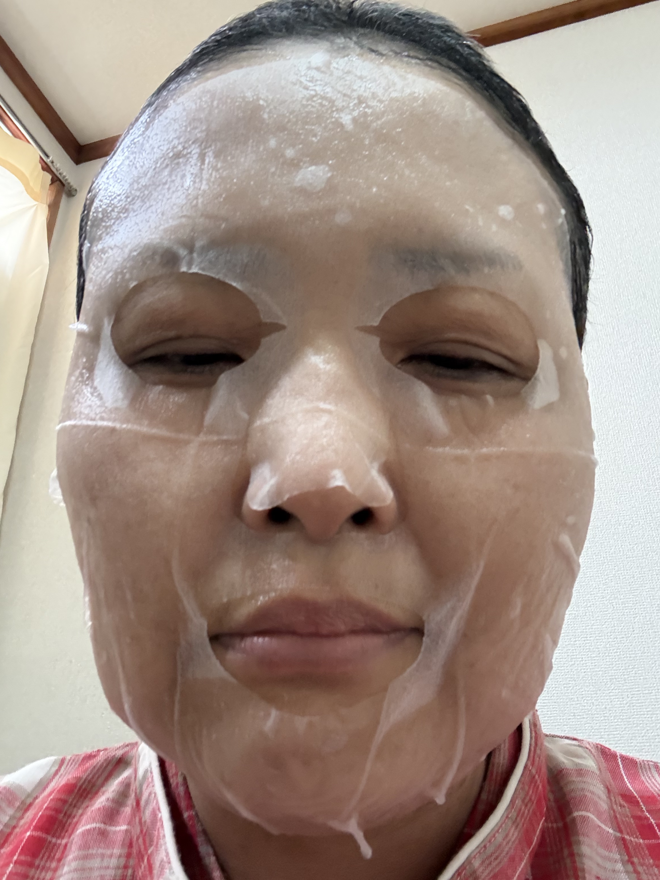 アノンコーワFF乳液/アノン/乳液を使ったクチコミ（2枚目）