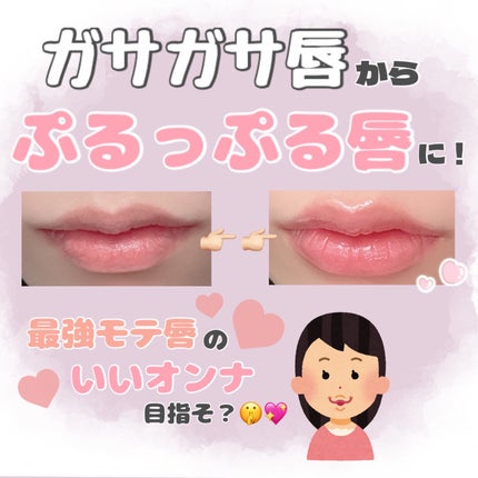 モアリップ A(医薬品)/資生堂薬品/その他を使ったクチコミ(1枚目)