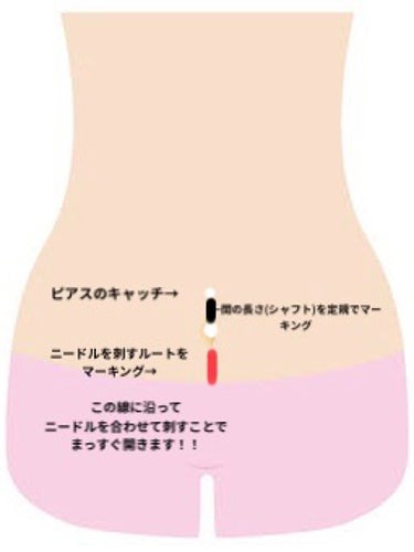 オロナインＨ軟膏 (医薬品)/オロナイン/その他を使ったクチコミ（3枚目）